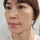 솔트약국 이미지