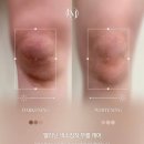 미백 이미지