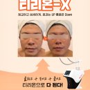 티리온