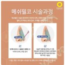 필코모아 이미지