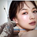 수아연한의원 | 눈썹 실리프팅 후기를 확인해 보세요(붓기 · 멍 · 부작용 무섭다면) 수아연한의원 시술법