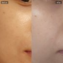 피부섬김 | 충남수기전문 피부샵 천안 백석동 "피부라인" 피부관리 후기