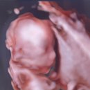 조아산부인과의원 이미지