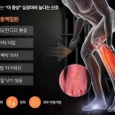 다리에 ‘이 증상’ 나타났다면, 심장마비·뇌졸중 위험 이미지