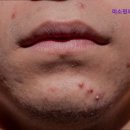 미소핀의원 이미지