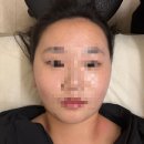 (주)셀핏 | [부천] 뷰티선셋 모공전문센터 부천본점 | 상동 에스테틱, 상동 피부관리, 상동 윤곽 관리로 예신 피부...