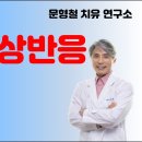 알레르기의 원인 &#39;파발부민&#39; 탐구 이미지