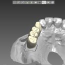 서울가족치과기공소 이미지