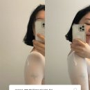 청담동에스테틱 가인미가 LPG엔더몰로지 관리 후기