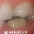 퍼펙트치과기공소 이미지