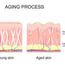 엘라스틴 부작용 엘라스틴 콜라겐 요약 정리 이미지