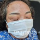 옥길동 갈매기 | 부천 옥길동눈썹 오래된 푸른 잔흔, 레이저 없이! 눈썹 커버업 시술 전/후 비교