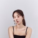 모우림의원 | 압구정 모발이식 [모발이식 후기 1년경과] 모우림의원 모발이식 절개 흉터 모발이식 부작용까지