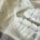 탑치과의원 | 출산 후 첫 스케일링 | 금천구 리더스탑치과 스케일링 후기
