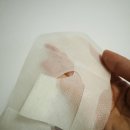 보툴리눔화장품 볼카 나노패치 럭셔리 홈케어 후기