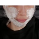 라임의앵글 | 강남역피부과 추천 울쎄라 리프팅 솔직 만족 후기!