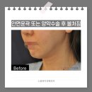 노블성형외과의원 이미지
