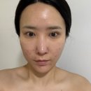 주안 윤곽관리 뉴벨라에스테틱 인천웨딩케어