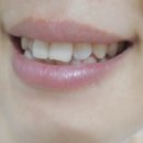 윤메디플러스 이미지