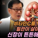 [편집전 미방영분] 이왕재 박사도 깜짝 놀랐습니다. 신장이 안 좋은 환자에게 비타민C 치료했더니 벌어지는 일 이미지