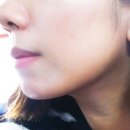 엔슬림의원 이미지