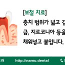 대신치과기공소 이미지