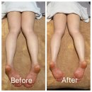 힐링명품뷰티 | [청담동에스테틱] 뷰티블르바드 연예인 슬리밍관리 60분 솔직 후기! (승모근, 종아리 집중 케어)