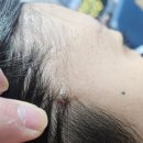 미앤숨송천의원 이미지