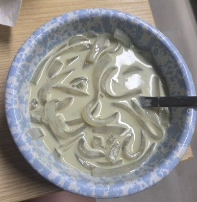 물을 많이 마셔야 합니다